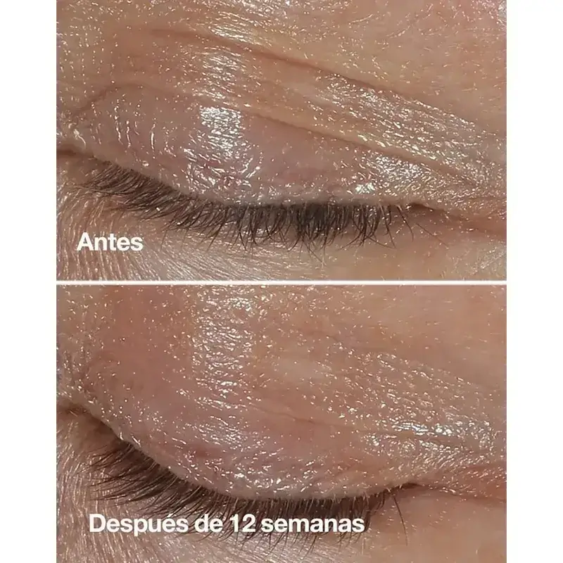 Clinique Smart Clinical Repair Anti-Wrinkle Correcting Eye Cream, 2x15 ml - Image 3