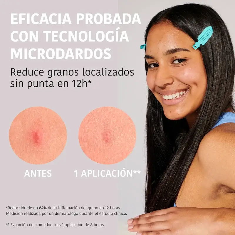 Iroha Nature Acne Prone Skin Microdart Patches, 12 pieces - Image 3